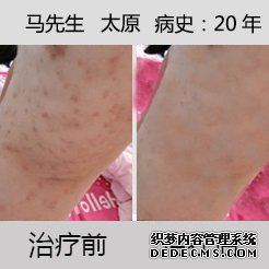 20年前，人生之路几多坎坷